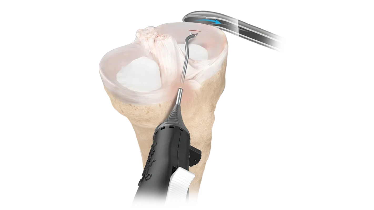 zonenavigator_system